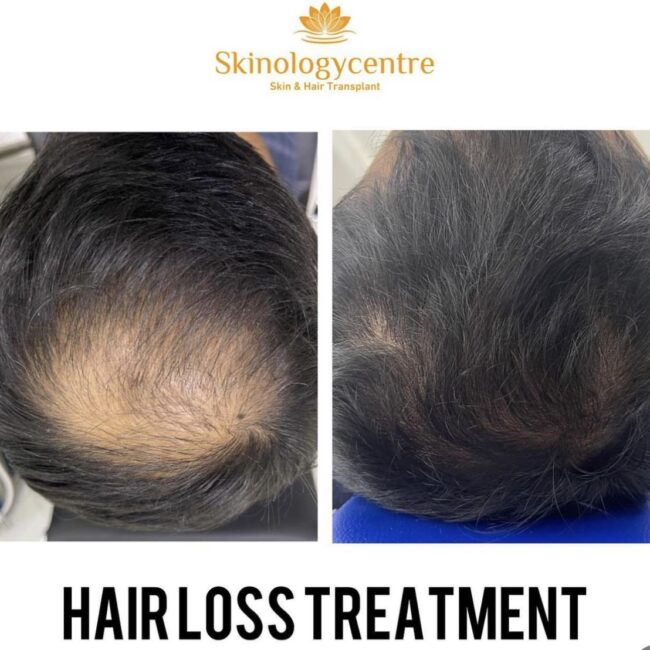 Before and after comparison for hair transformation