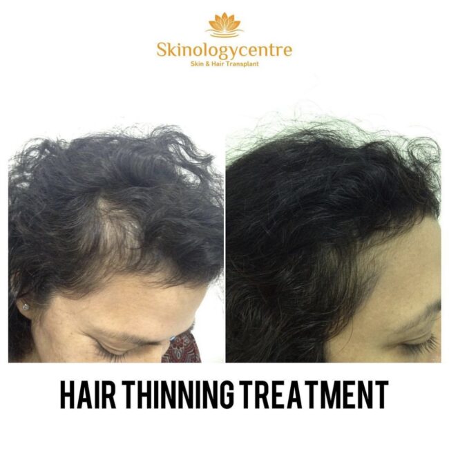 Before and after comparison for hair transformation