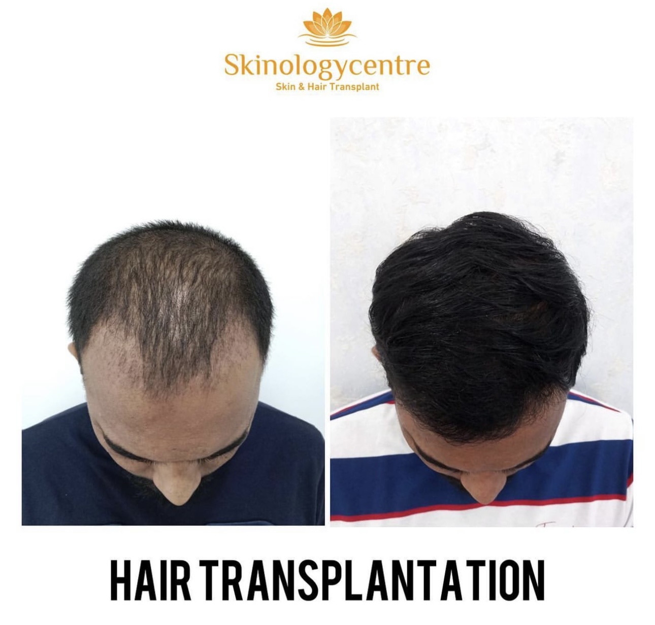 Before and after comparison for hair transformation