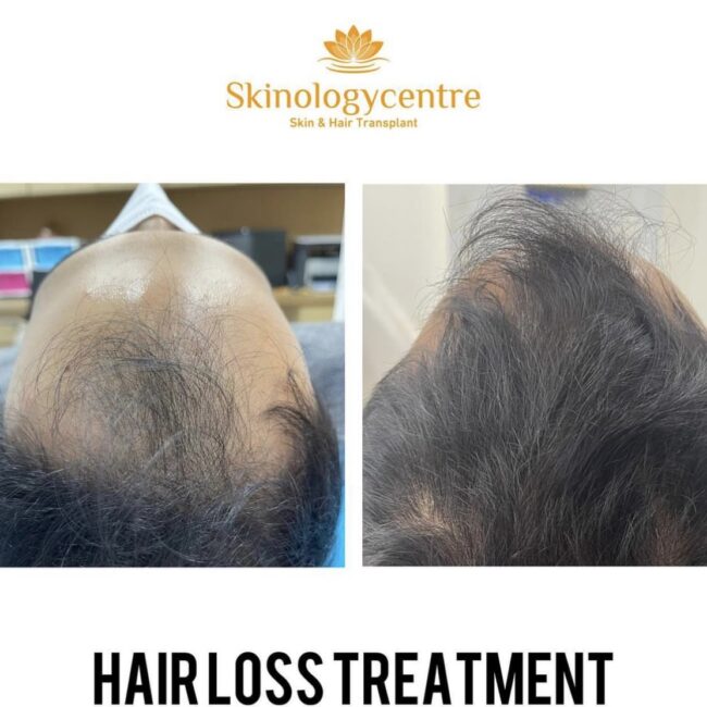 Before and after comparison for hair transformation